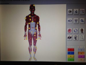 Fig. 6. Example of hardware 3D visualization of a muscles functional condition of a bicyclist with torsion of body organs.