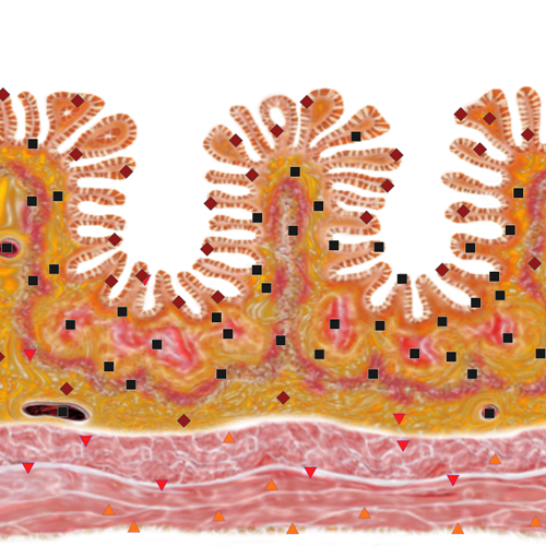 Possibilities of virtual NLS-graphy in screening of colorectal cancer ...